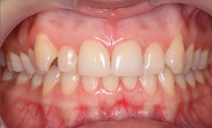 Before image