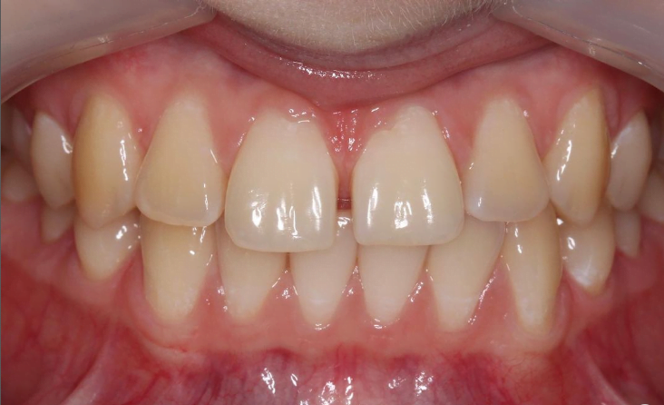Before image