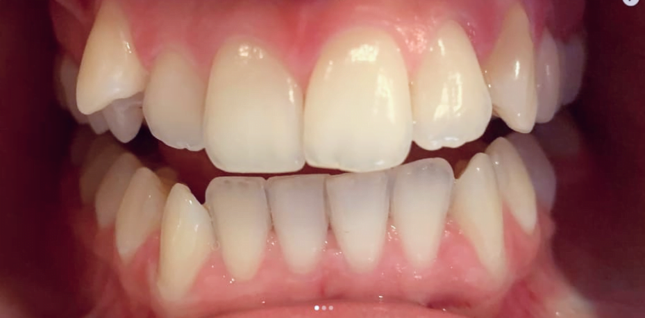 Before image